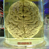 cerebro humano en frasco